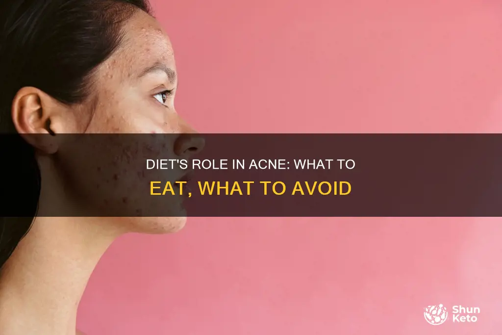 does diet cause acne
