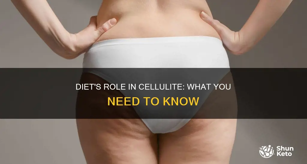 does diet cause cellulite