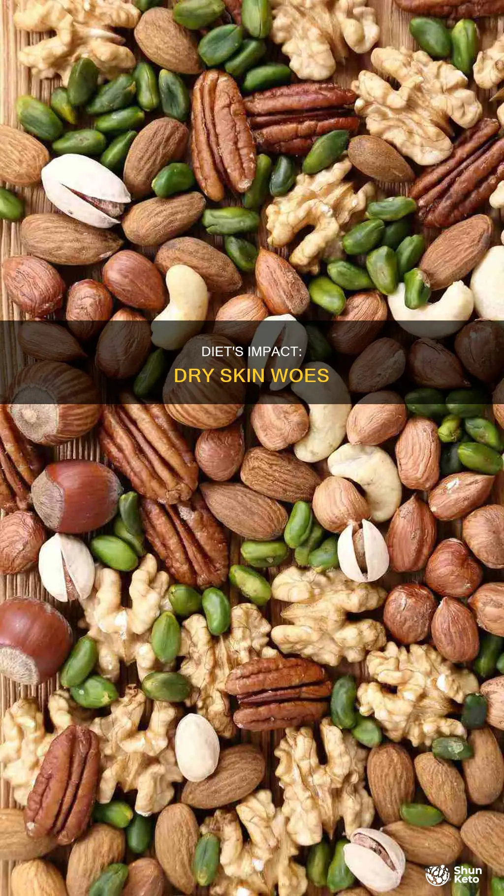 does diet cause dry skin