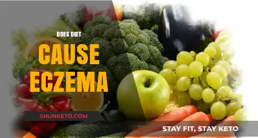 Diet's Role in Eczema: What You Need to Know