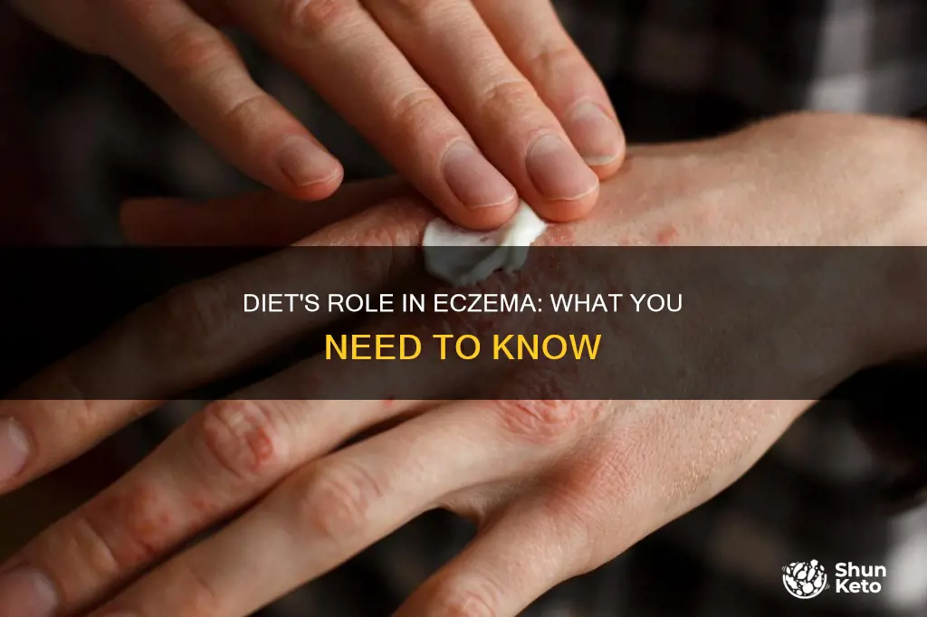does diet cause eczema