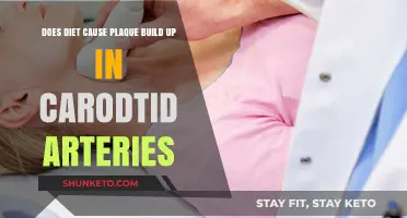 Diet and Plaque Build-up: What's the Connection?