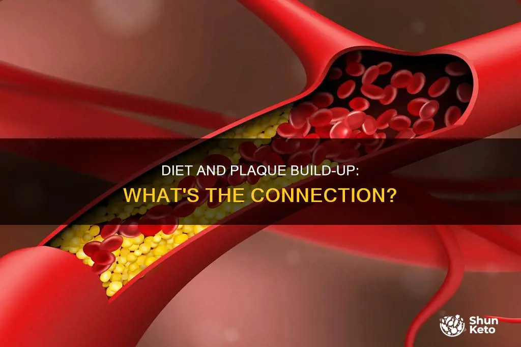 does diet cause plaque build up in carodtid arteries