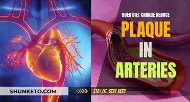 Diet Changes: Reducing Plaque in Arteries
