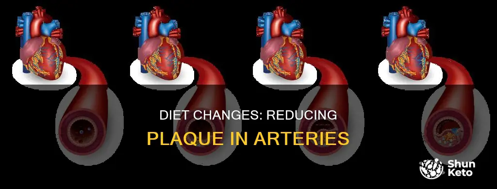 does diet change reduce plaque in arteries