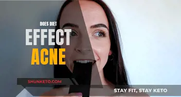 Diet's Impact on Acne: What to Know