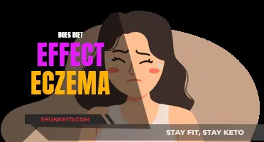 Diet's Impact on Eczema: What You Need to Know