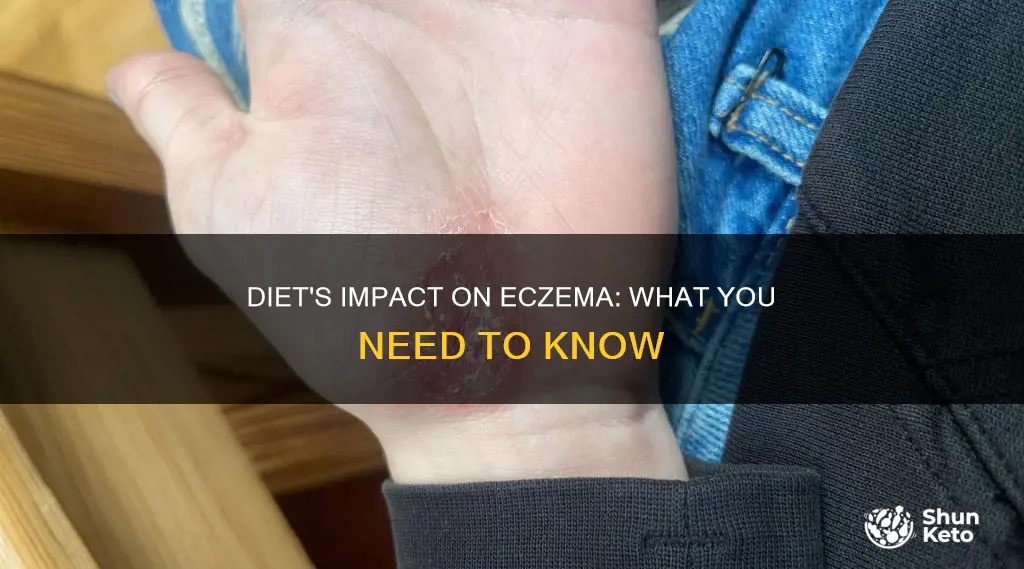 does diet effect eczema