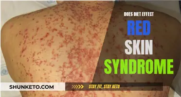 Diet's Impact on Red Skin Syndrome: What You Need Know