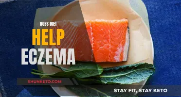Eczema and Diet: What You Need to Know
