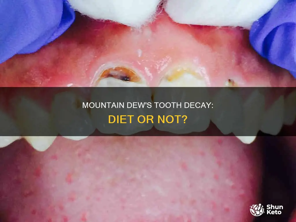does diet mountain dew cause tooth decay