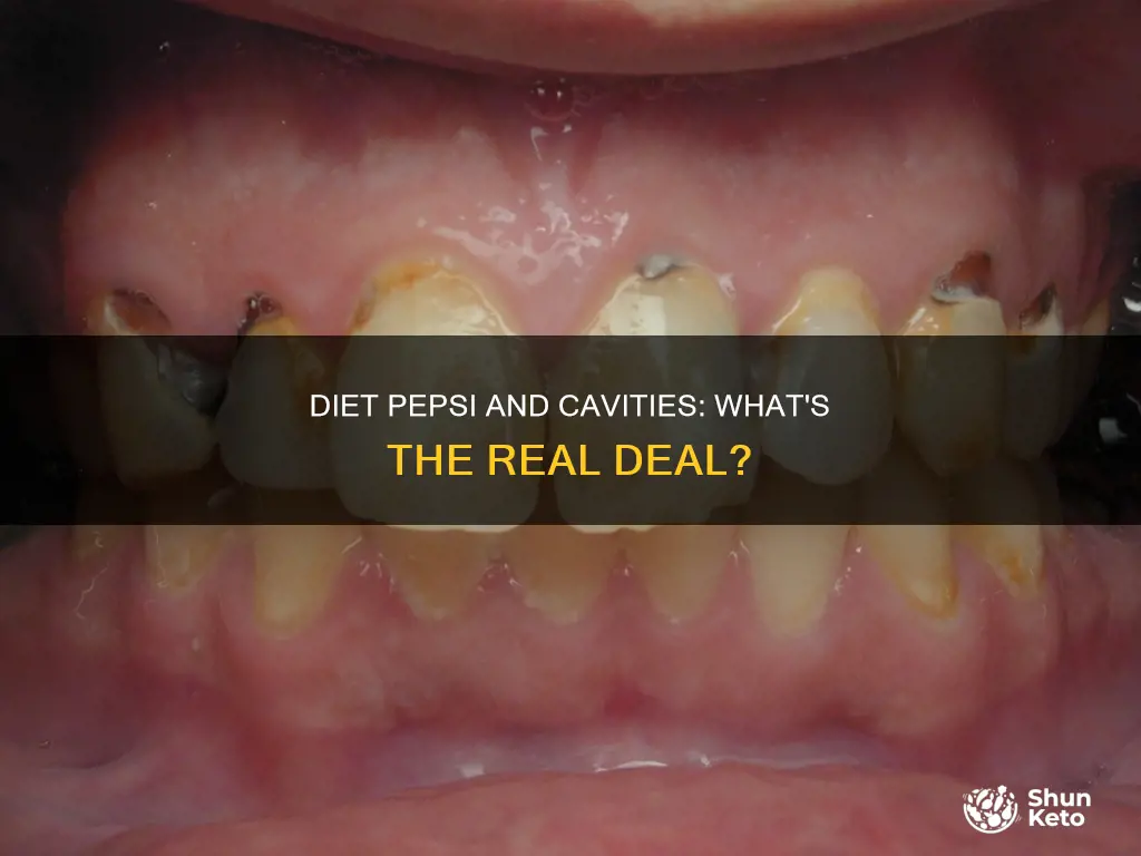 does diet pepsi cause cavities