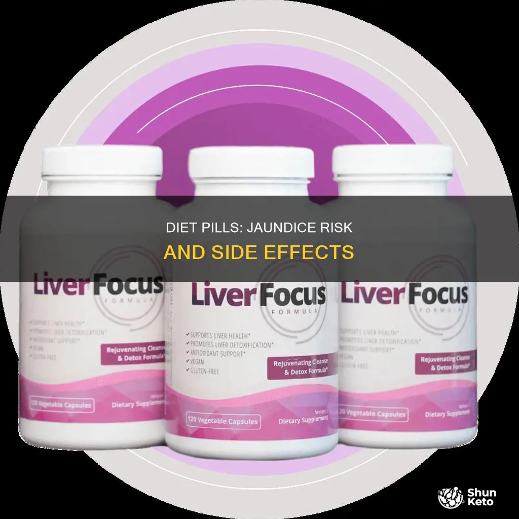 does diet pill cause jaundice