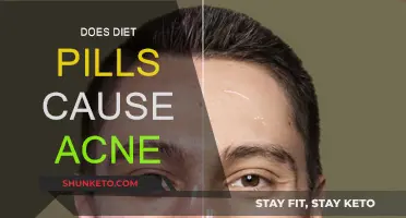 Diet Pills and Acne: Is There a Link?