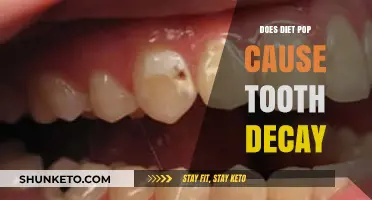 Tooth Decay and Diet Pop: What's the Truth?