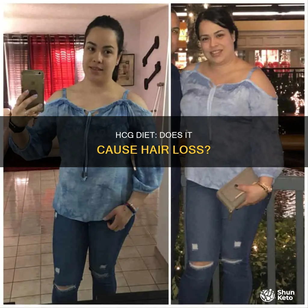 does doing hcg diet make you lose hair