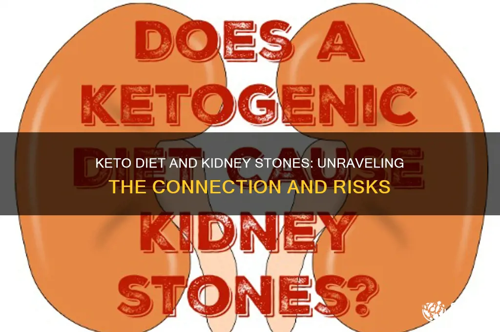 does eating keto cause kidney stones