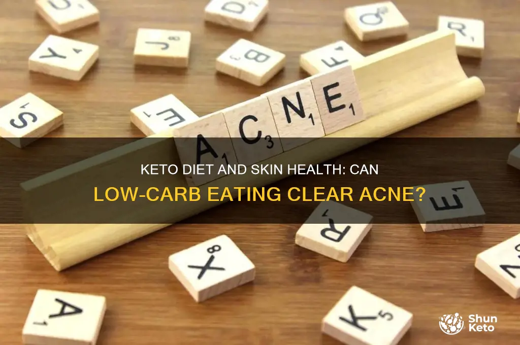 does eating keto clear skin