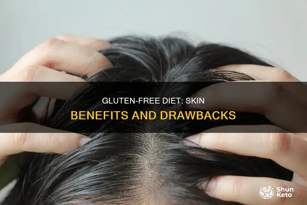 does gluten ffree diet help skin