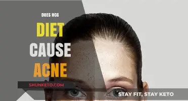 HCG Diet: Friend or Foe to Skin?