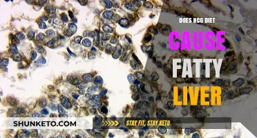 HCG Diet: Fatty Liver Friend or Foe?