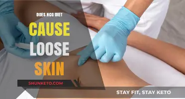 HCG Diet: Does It Cause Loose Skin?