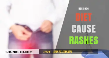 HCG Diet: Understanding the Link to Skin Rashes