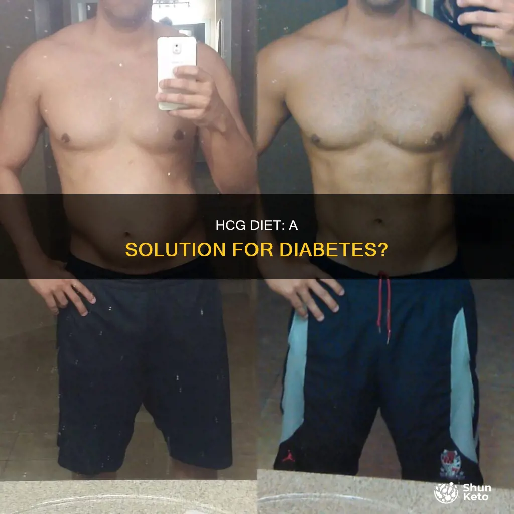 does hcg diet help with diabetes