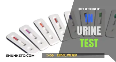 Does Ketamine Show Up in Urine Tests? Detection Window Explained