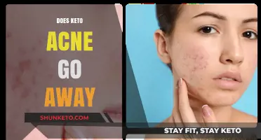 Does Keto Acne Go Away? Understanding and Managing Skin Changes