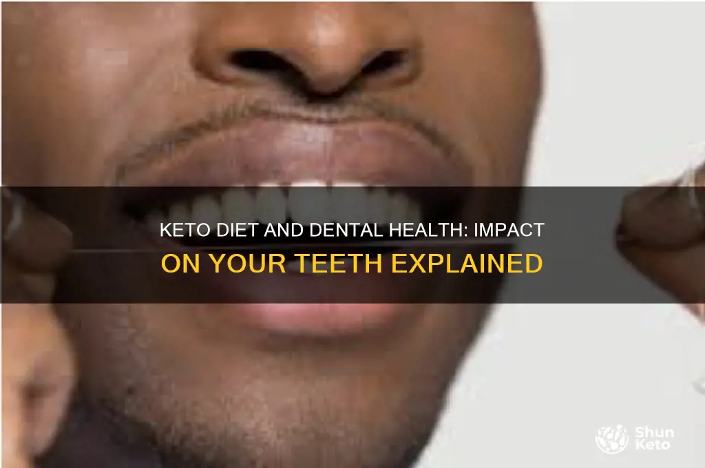 does keto affect my teeth