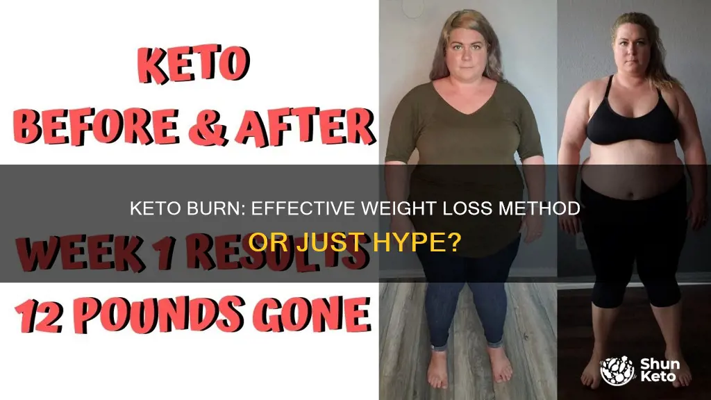 does keto burn work for weight loss