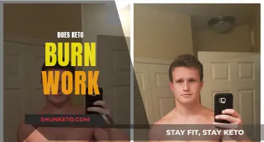 Keto Burn: Does It Work?