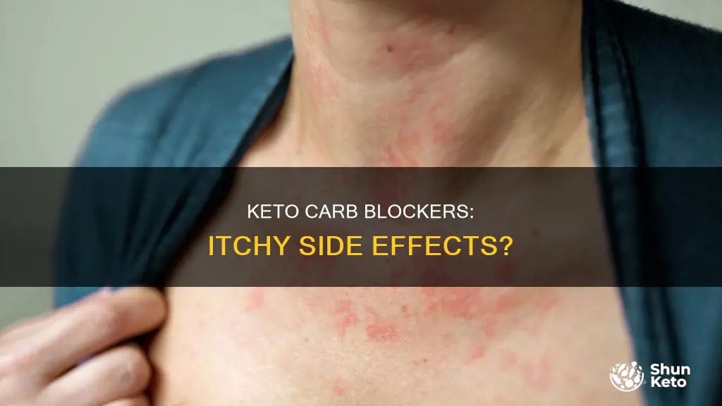 does keto carb blockers cause itching