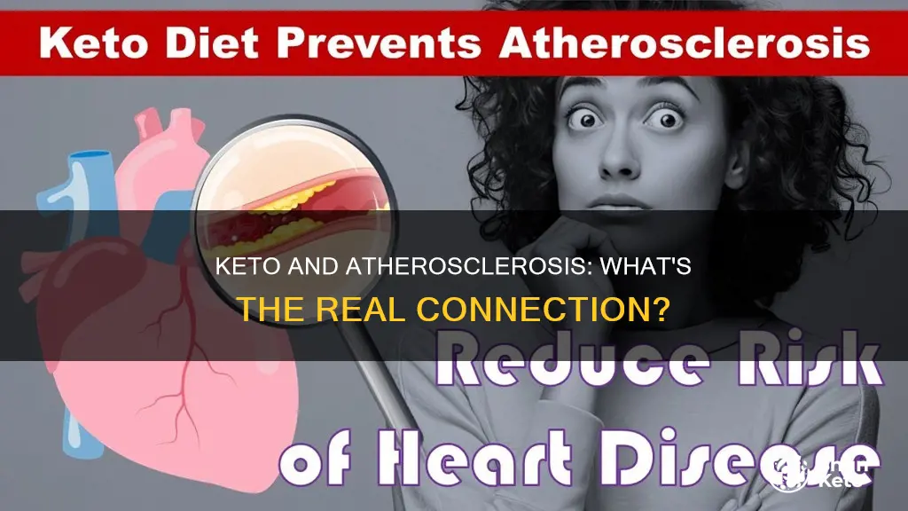 does keto cause atherosclerosis