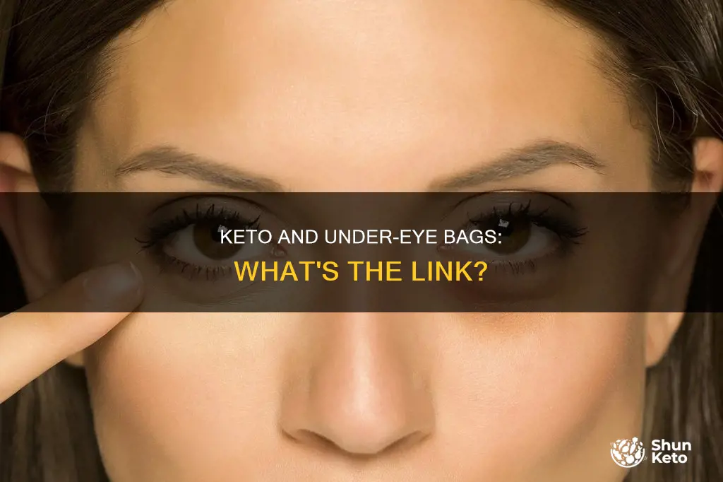 does keto cause bags under eyes