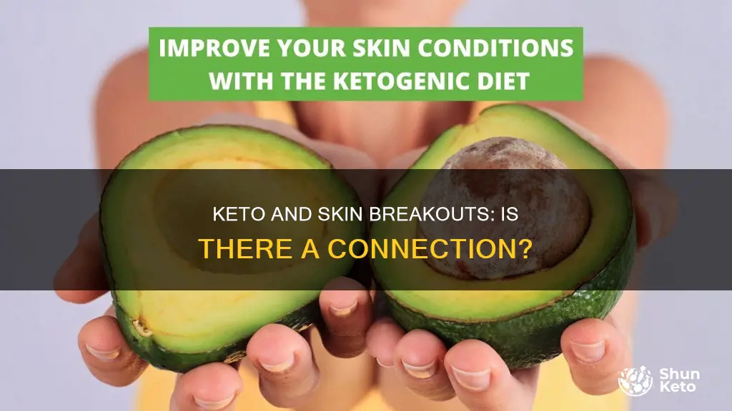 does keto cause breakouts