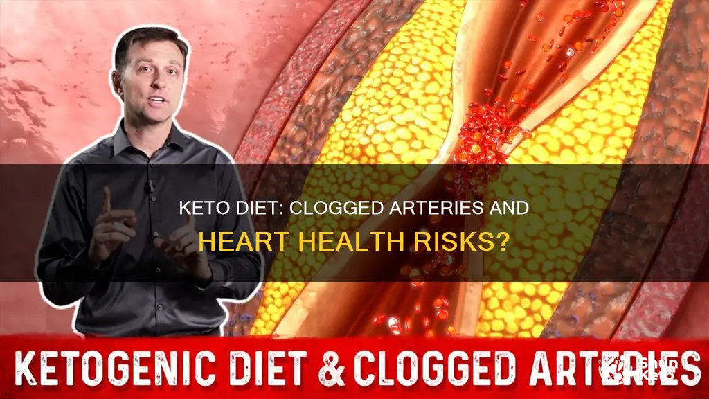 does keto cause clogged arteries