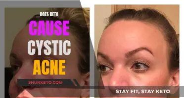 Keto and Cystic Acne: Is There a Link?