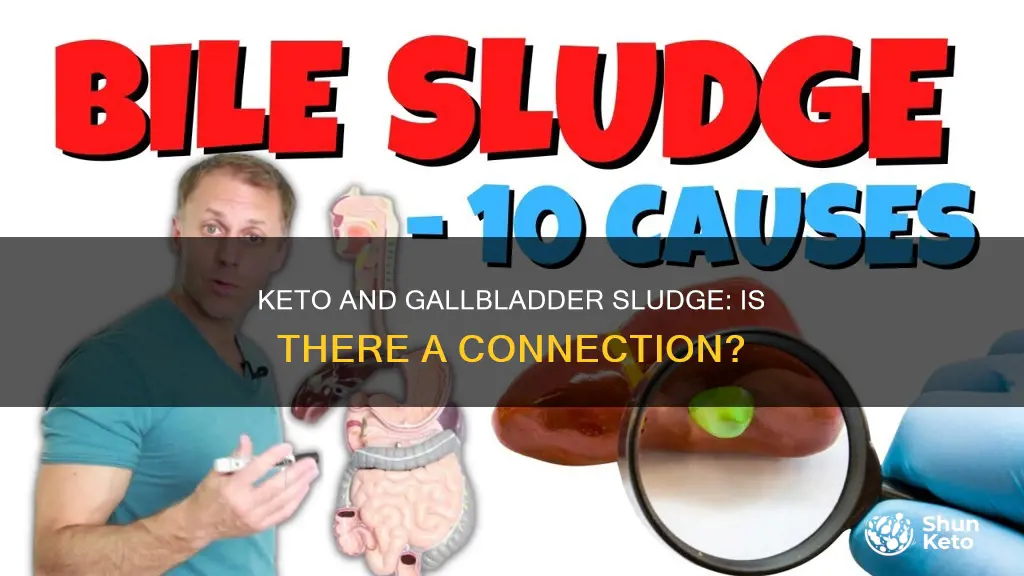 does keto cause gallbkaddet sludge