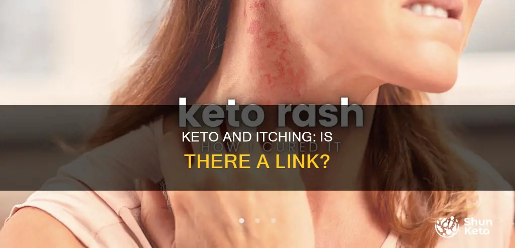 does keto cause itching