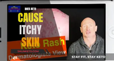 Keto Diet: Itchy Skin Side Effect Explained