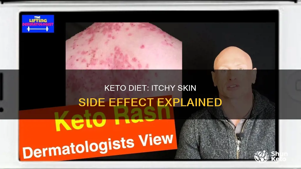 does keto cause itchy skin