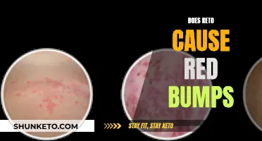 Keto and Red Bumps: What's the Connection?