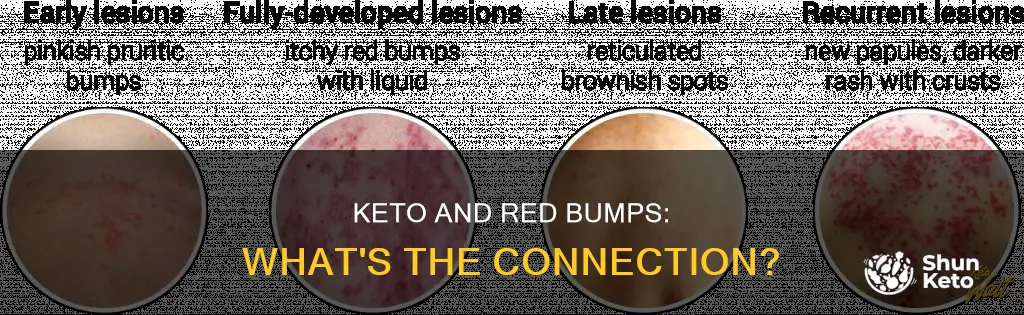 does keto cause red bumps