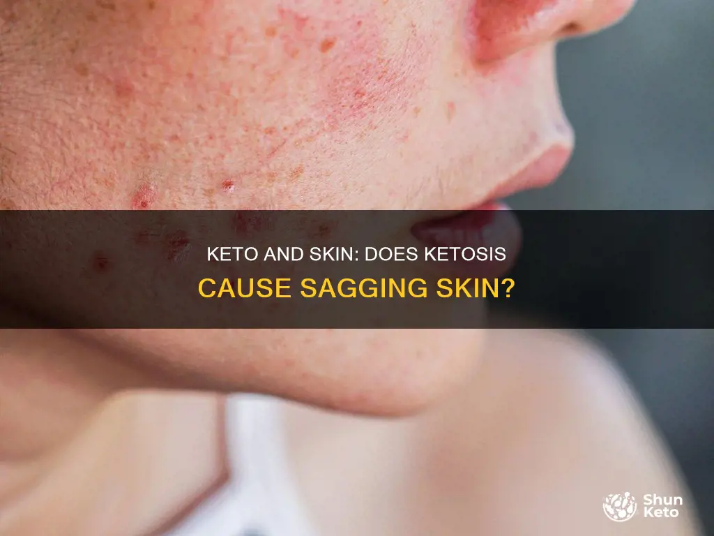 does keto cause sagging skin