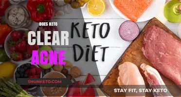 Can Keto Diet Clear Acne? Exploring the Skin Benefits of Ketosis