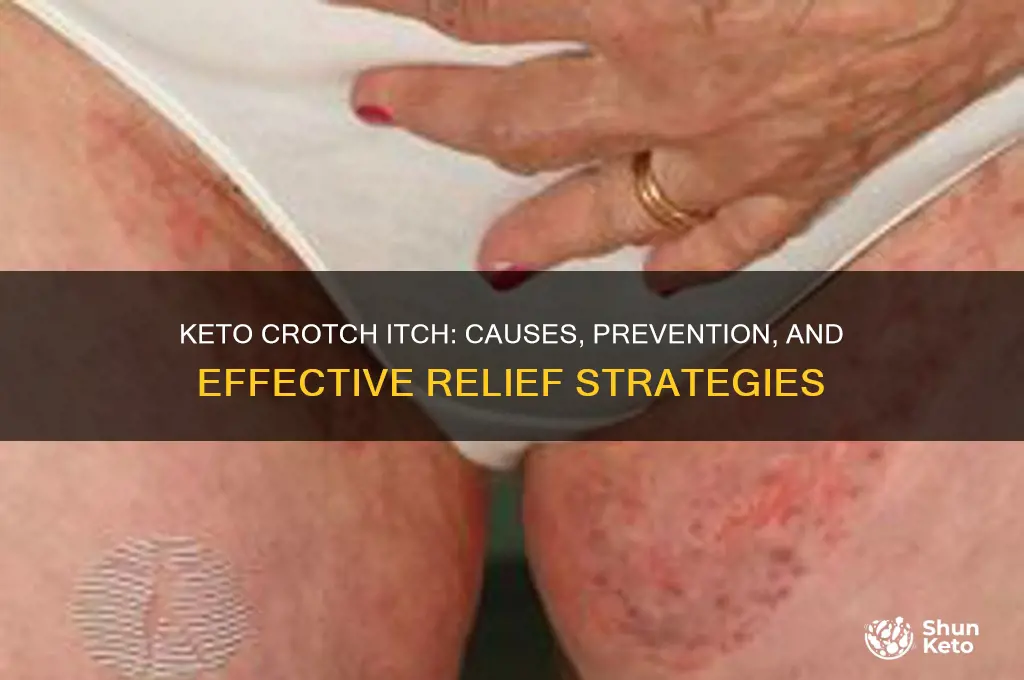 does keto crotch itch