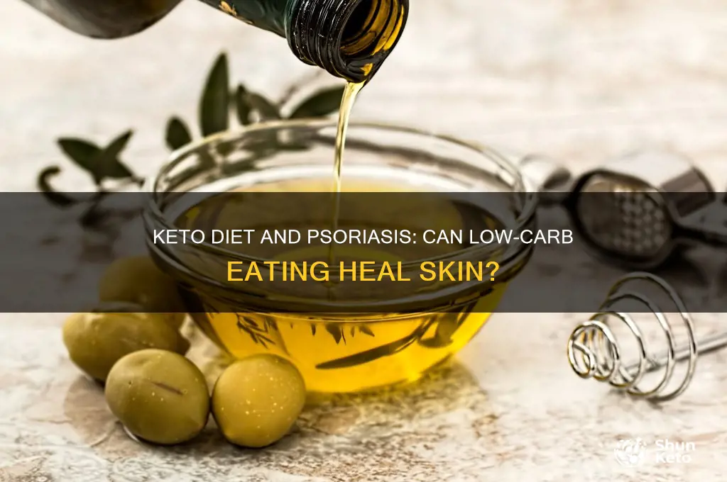 does keto cures psoriasis