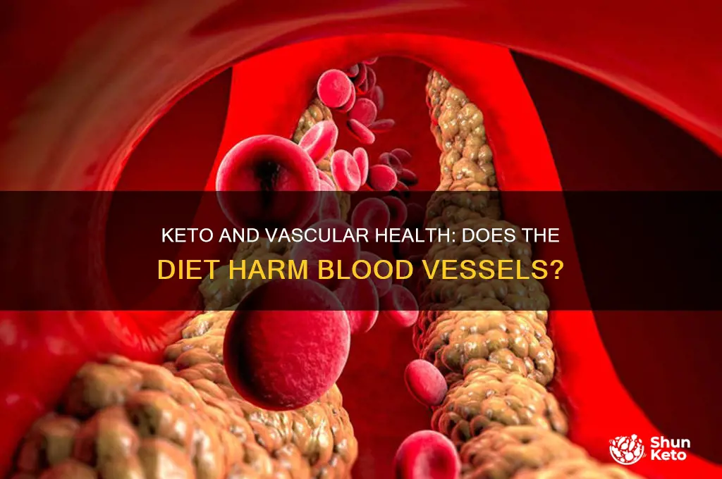 does keto damage blood vessels